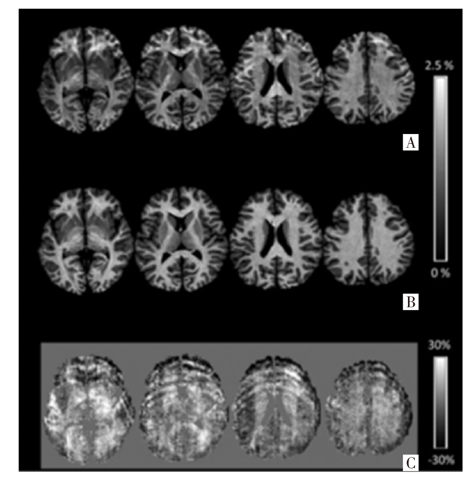 Synthetic MRI: principles, techniques, and applications